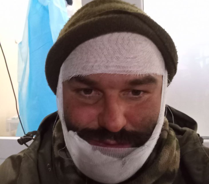 Экс-депутату пермского Заксобрания Александру Григоренко при обстреле выбило зуб осколком