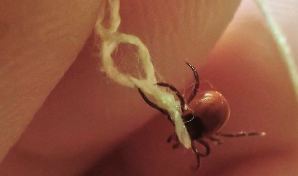 В Прикамье клещи укусили восемь человек
