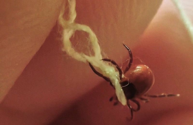 В Прикамье клещи укусили 125 человек 